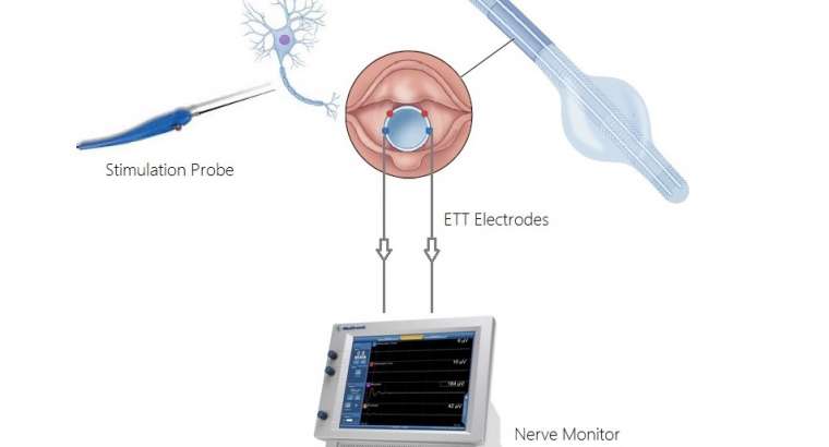 Sinir Monitörizasyonu Nedir? Niçin Yapılır?